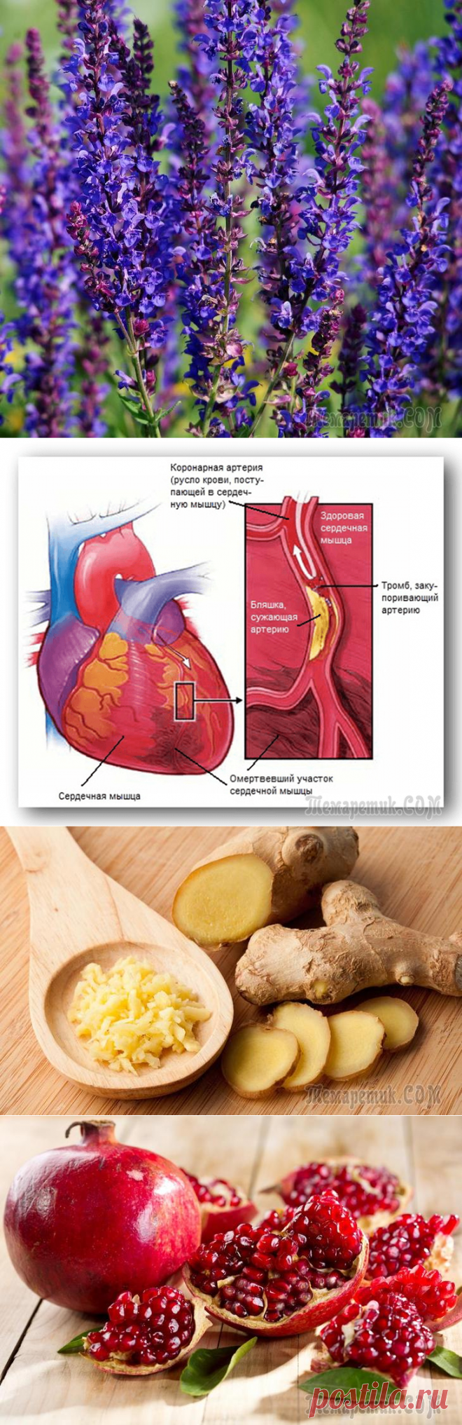 От тромбоза до тромбона – один шаг. 5 простых и надёжных советов, чтобы жить долго без тромбов