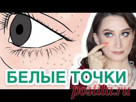 Милиумы - это болезнь❓ИЗБАВЛЯЕМСЯ НАВСЕГДА❗️
