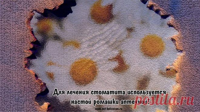 Стоматит: В чём состоит лечение, чтобы устранить причины? 

Десны могут кровоточить при малейших прикосновениях.

В качестве лечения можно использовать настой ромашки аптечной.