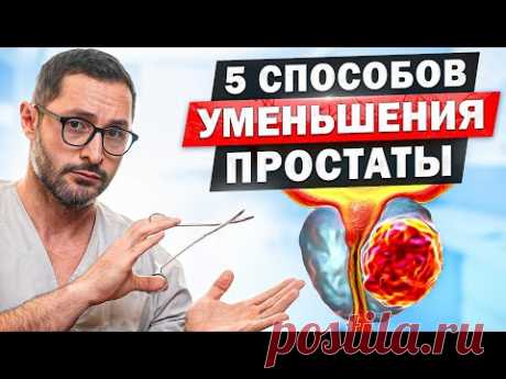Что делать при увеличенной простате? Способы уменьшения простаты и последствия