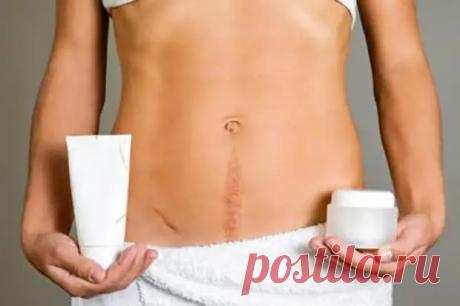 Левом рубцы