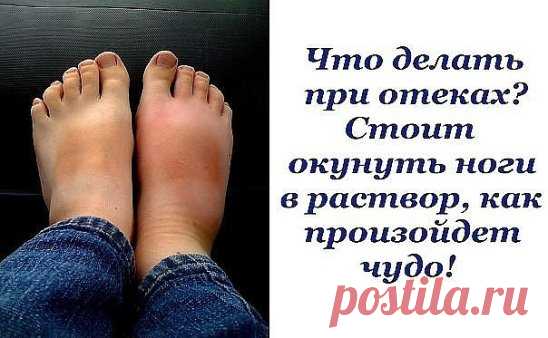 Опухшие ноги — больше, чем простая неприятность. Это болезненное, утомительное состояние, и не всегда его можно победить пассивным отдыхом в кровати…
Причины отеков многочисленны: от длительного сидения во время путешествия до неудобной обуви и плохой работы почек. Рекомендую не спешить принимать всевозможные лекарственные препараты и обойтись средствами, проверенными не одним поколением 
Мочегонное при отеках ног
Настой из петрушки
Чтобы приготовить настой из петрушки для снятия отечности,
