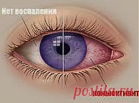 Сбор конъюнктивиту даст отпор | Друг пенсионера
Человек, к сожалению, существо очень хрупкое, и неприятности могут подстерегать его на каждом шагу. Вот, например, какую-нибудь вирус­ную болезнь можно подхватить, сов­сем и не подозревая об этом.