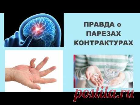 ПРАВДА о ПАРЕЗЕ , КОНТАКТУРАХ