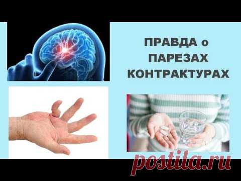 ПРАВДА о ПАРЕЗЕ , КОНТАКТУРАХ