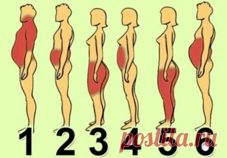 6 типов ожирения: о чём говорят лишние сантиметры на твоем теле