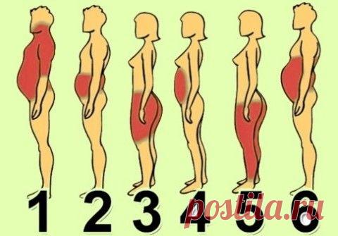 6 типов ожирения: о чём говорят лишние сантиметры на твоем теле