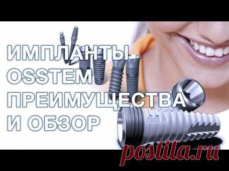 Osstem импланты преимущества и недостатки. Имплантация зубов.