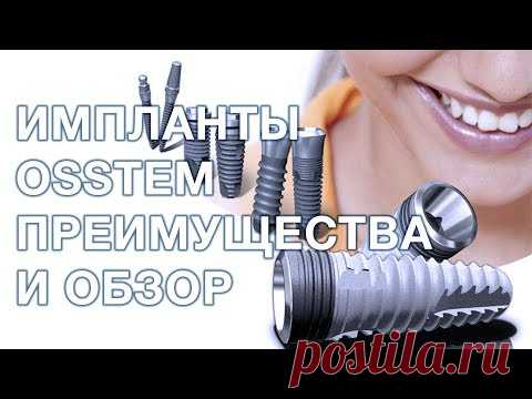 Osstem импланты преимущества и недостатки. Имплантация зубов.
