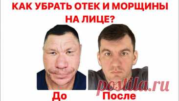 Смотрите видео онлайн «Навсегда убрал отек на лице и морщины