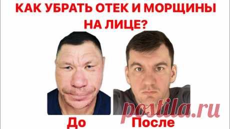 Смотрите видео онлайн «Навсегда убрал отек на лице и морщины
