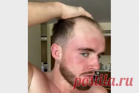 Мужчина показал простой способ скрыть залысины на голове. Мужчина раскрыл способ скрыть залысины на голове и порадовал подписчиков. Пользователь с никнеймом @kegs97 показал свою укладку, которая помогает ему спрятать лысеющую линию роста волос на лбу. Он распылил коричневую краску на лысые участки кожи головы, чтобы визуально замаскировать их.