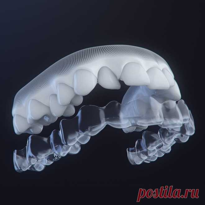 Элайнеры Invisalign для исправления прикуса. Клиника iortho специализируется на выравнивание зубов с помощью прозрачных капп — элайнеров. Элайнеры это альтернатива брекетам: удобно носить, быстрое привыкание, безболезненно. На первой консультации вы узнаете, как будет выглядеть ваша улыбка после курса лечения блогодаря 3д-модели. Элайнеры подходят детям и у них практически нет противопоказаний, поэтому элайнеры Invisalign можно носить во время беременности