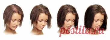Сильно выпадают волосы? Простой рецепт решит проблему! — Journal women❜s