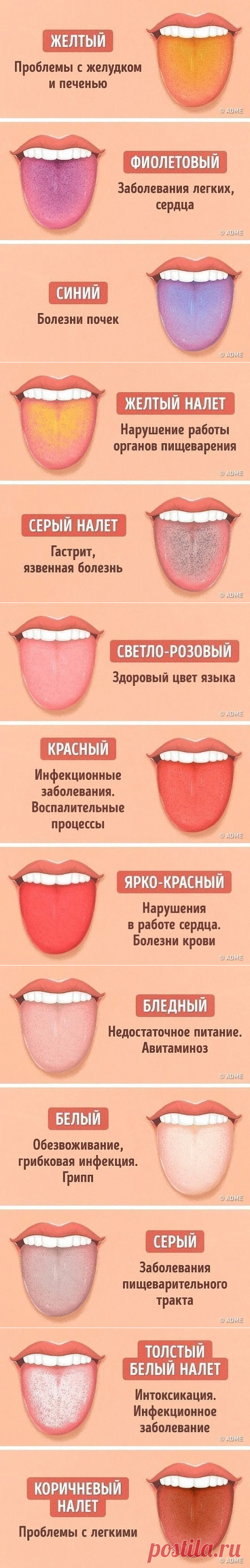 (75) Одноклассники