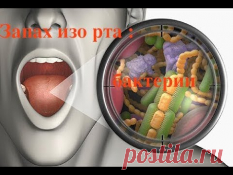 ЛЕЧЕНИЕ НЕПРИЯТНОГО ЗАПАХА ИЗО РТА . КАК ВЫЛЕЧИТЬ #ГАЛИТОЗ #запах_изо_рта #111 #oldenburg_ru - YouTube