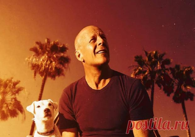 Принц Уильям, Брюс Уиллис и другие: как выглядели бы известные лысые мужчины с волосами