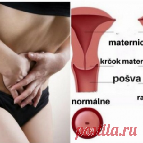 До появления рака шейки матки, тело предупреждает заранее. - МирТесен