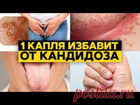 Кандидоз есть в КАЖДОМ из нас! / Как защитить свою микрофлору с помощью эфирных масел?