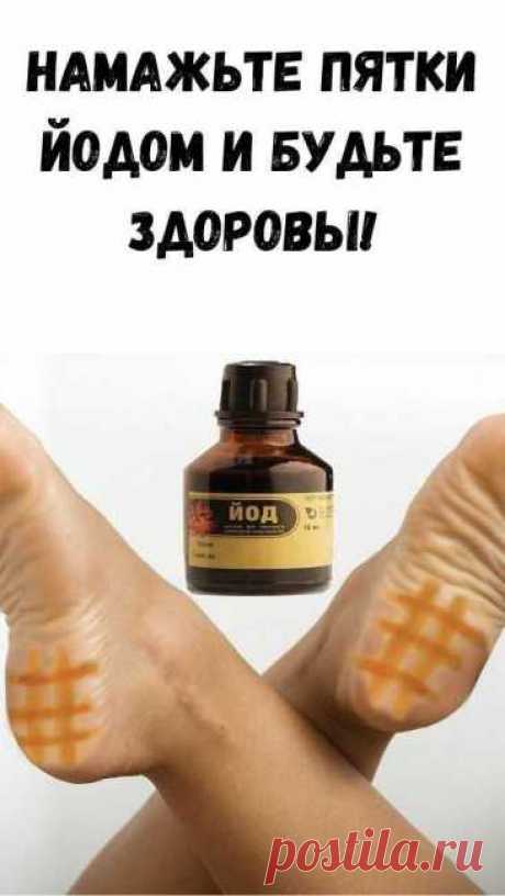 Сетка йода на пятки
Если нанести йод на пятки, то это ускорит кровообращение и поможет избавиться от отёка ног. Йод поднимает температуру тела, поэтому йодная сетка помогает при простудных заболеваниях и насморке. Йод наносится не по всей поверхности кожи, а именно сеткой, чтобы избежать ожогов.