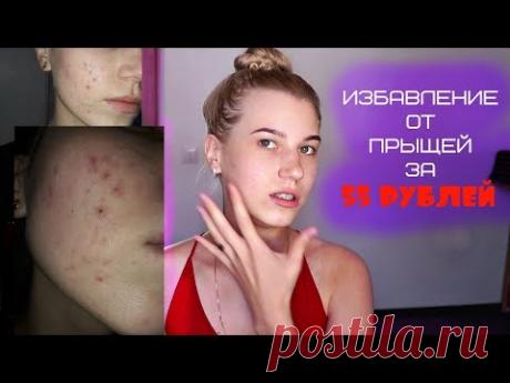 АНТИ АКНЕ / САЛИЦИЛОВАЯ Маска ОТ ПРЫЩЕЙ #ВикторияБу - Лучшее видео с интернета #проблемнаякожа #пропелер #маскаотчерныхточек #маскаотжирногоблеска #глубокоеочищение #лучшаяантиугреваякосметика