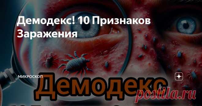Демодекс! 10 Признаков Заражения Статья автора «МИКРОСКОП» в Дзене ✍: Demodex – это род микроскопических клещей. Они живут на коже человека и млекопитающих, питаются кожным салом и омертвевшими клетками кожи.