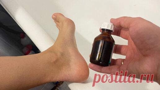 Теперь у меня пятки всегда нежные, как у младенца! Простой и дешевый способ, который легко поможет убрать огрубевшую кожу на ногах | Pochavkaem | Личный блог | Дзен