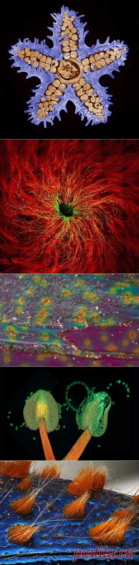 Снимки финалистов конкурса Nikon Small World 2015 — Фотоискусство
