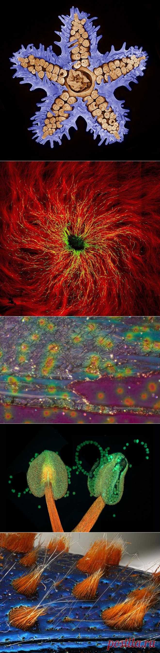 Снимки финалистов конкурса Nikon Small World 2015 — Фотоискусство