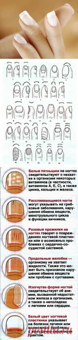 О КАКИХ ЗАБОЛЕВАНИЯХ ГОВОРЯТ ИЗМЕНЕННЫЕ НОГТИ))