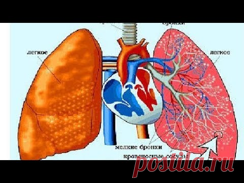 Поражение лёгких. Сатурация. Упражнения. Кислородный аппарат не помощник.