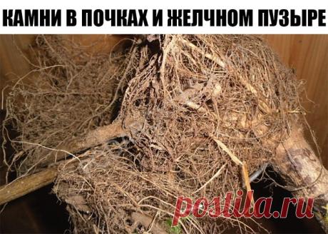 Камни в желчном пузыре,в почках. 

Хочу поделиться некоторыми рецептами, которые я испытал на себе в борьбе за свое здоровье. 

Лет пять назад меня увезли на «скорой» в больницу с приступом колик в печени. При обследовании выяснилось, что в желчном пузыре три камня: 1,2 см, 1 см и 0,8 см. Хотели резать, но я отказался и стал лечиться домашними способами. 

Вначале пил урину по 3-5 глотков 3 раза в день. Затем узнал рецепт с корнем подсолнуха и стал пить его настой. Провери...