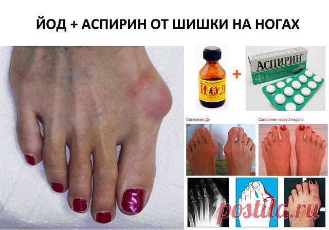 (66) Одноклассники