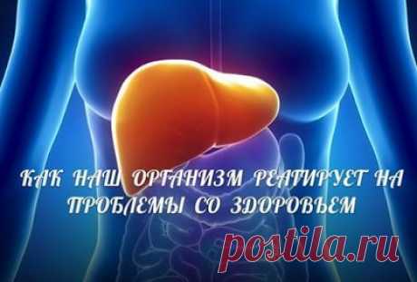 КАК НАШ ОРГАНИЗМ РЕАГИРУЕТ НА ПРОБЛЕМЫ СО ЗДОРОВЬЕМ?  Потрескавшиеся губы, белый налет на языке...