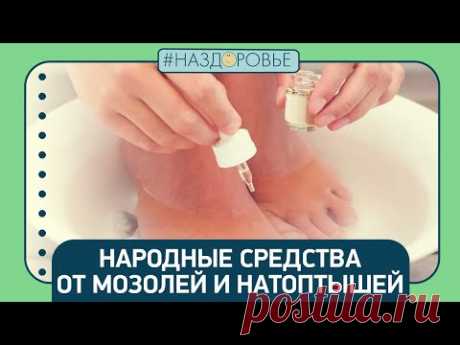 #НАЗДОРОВЬЕ: народные средства от мозолей