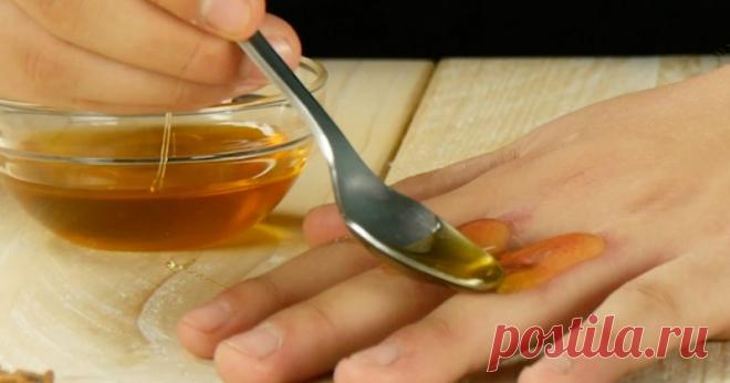 8 удивительных домашних средств от головной боли, синяков и ожогов. Гениально!