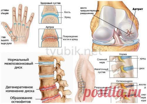 Кыст Аль-Хинди для чего помогает, какие болезни лечит