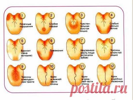 Как по языку узнать о сбоях в работе позвоночника, желудка, печени и предотвратить их? 

В медицине очень мало правил без исключений, но среди них есть одно такое правило: симптомы заболеваний проявляются на языке примерно за сутки–двое до того, как начинают болеть пораженные органы.
Показать полностью…