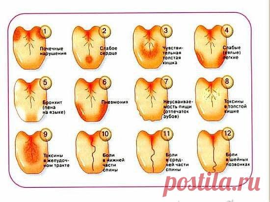 Как по языку узнать о сбоях в работе позвоночника, желудка, печени и предотвратить их? 

В медицине очень мало правил без исключений, но среди них есть одно такое правило: симптомы заболеваний проявляются на языке примерно за сутки–двое до того, как начинают болеть пораженные органы.
Показать полностью…