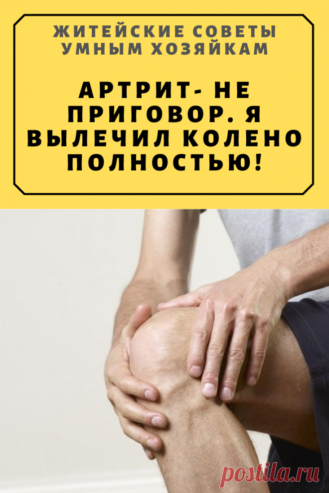 Артрит- не приговор. Я вылечила колено полностью! | Житейские Советы