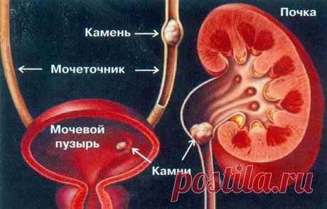 ОЧИЩЕНИЕ ПОЧЕК (РЕЦЕПТЫ НАРОДНОЙ МЕДИЦИНЫ).