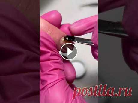 Как избавится от отслоек! #маникюр #ногти #дизайнногтей #весеннийманикюр #ногти2022 #маникюрмосква Как избавится от отслоек! #маникюр #ногти #дизайнногтей #весеннийманикюр #ногти2022 #маникюрмосква...