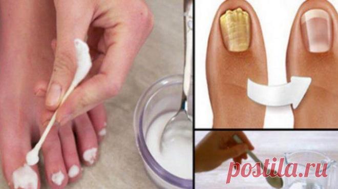Я долго не могла удалить грибок с ногтя, пока я не сделала это. Результат меня очень порадовал Наши ногти являются частью наших рук, и ног, хотя они не имеют жизненно важного смысла, как сердце или другой орган, но они также необходимы.
Мы привыкли видеть их на наших рук.
Причина, которая влияе…