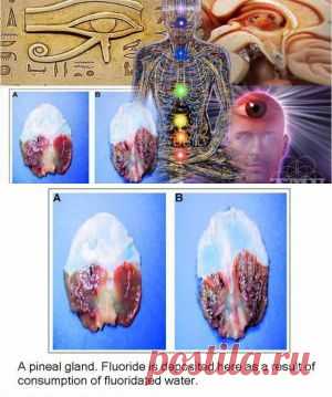 5 Ways to Decalcify Your Pineal Gland Regardless Of Your Age | Spirit Science