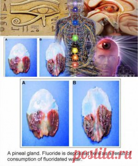 5 Ways to Decalcify Your Pineal Gland Regardless Of Your Age | Spirit Science