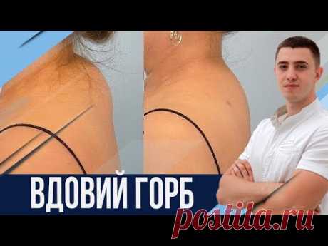 Холка. Как можно дома ее убрать?