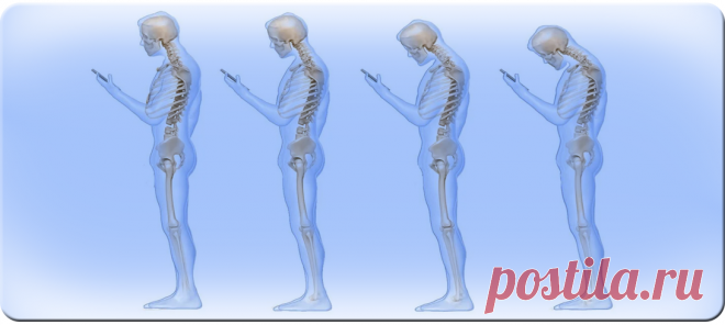 Пять вредных привычек с точки зрения ортопедии | Сам Себе Ортопед. Спб. | Яндекс Дзен