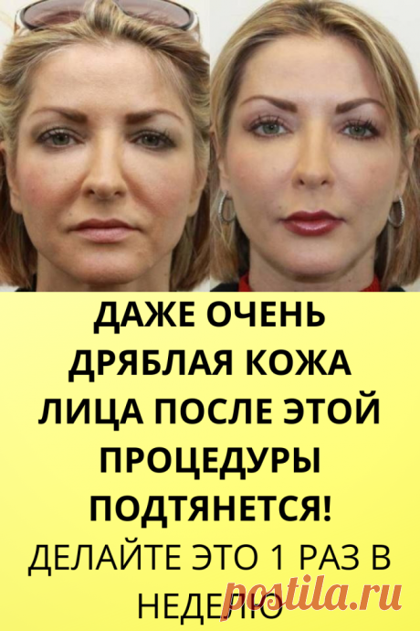 Даже очень дряблая кожа лица после этой процедуры подтянется! Делайте это 1 раз в неделю - Интересный блог