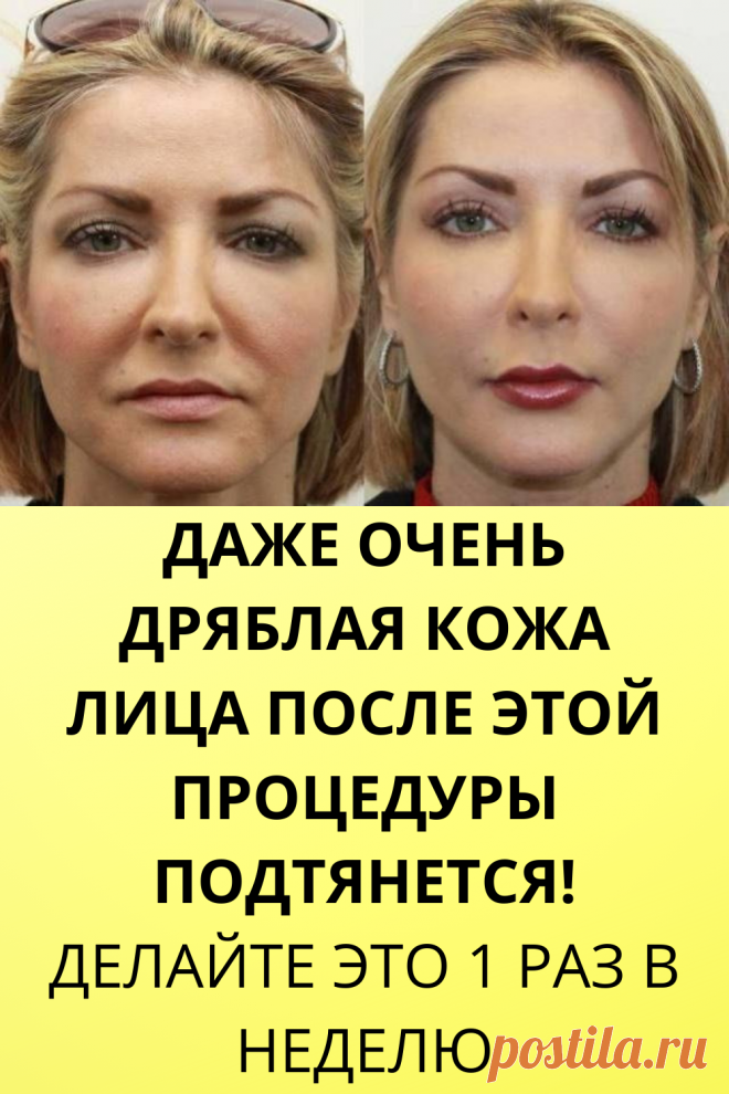 Даже очень дряблая кожа лица после этой процедуры подтянется! Делайте это 1 раз в неделю - Интересный блог