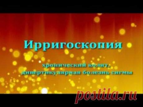 Ирригоскопия кишечника: показания, подготовка и техника процедуры